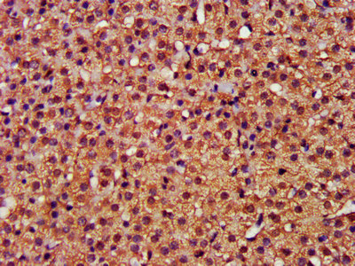 CSB-PA005282LA01HU