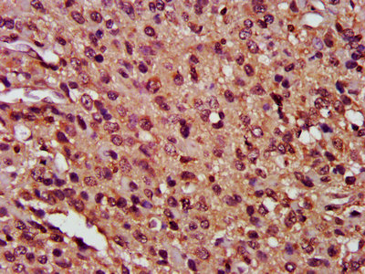 CSB-PA005282LA01HU