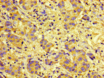 CSB-PA006255LA01HU