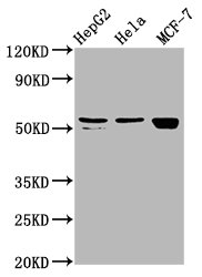 CSB-PA006844LA01HU
