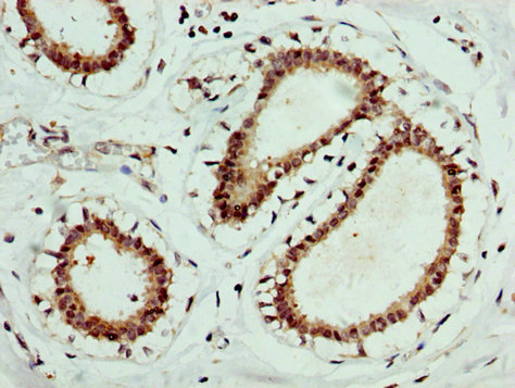 CSB-PA007744LA01HU