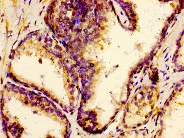 CSB-PA007918LA01HU
