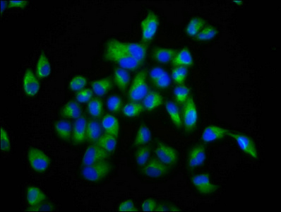 CSB-PA008786LA01HU