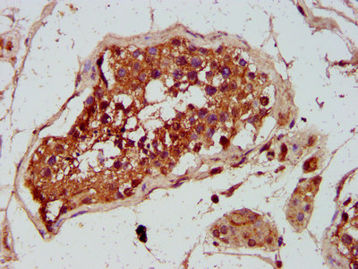 CSB-PA009892LA01HU