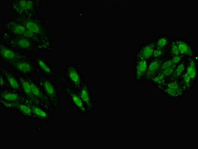 CSB-PA009991LA01HU