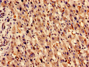 CSB-PA010583LA01HU