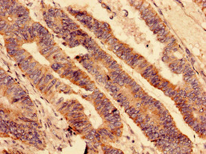 CSB-PA010583LA01HU