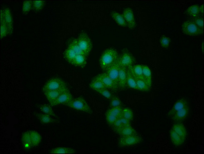 CSB-PA011624LA01HU