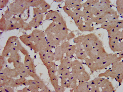 CSB-PA011624LA01HU