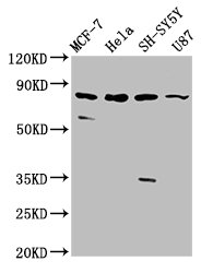 CSB-PA011624LA01HU