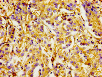 CSB-PA011861LA01HU