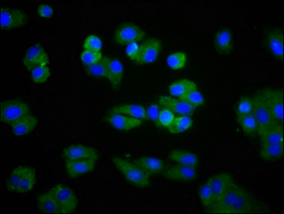 CSB-PA013065LA01HU