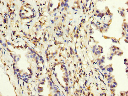 CSB-PA013329LA01HU