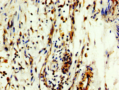 CSB-PA015387LA01HU