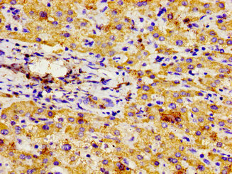 CSB-PA016025LA01HU