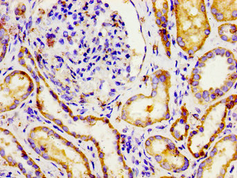 CSB-PA016025LA01HU