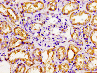 CSB-PA016058LA01HU