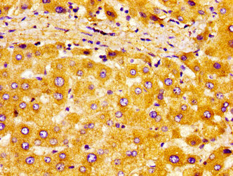 CSB-PA016058LA01HU