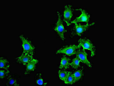 CSB-PA016331LA01HU