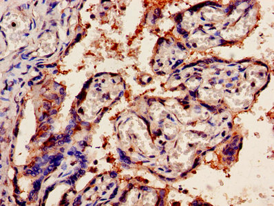 CSB-PA016331LA01HU