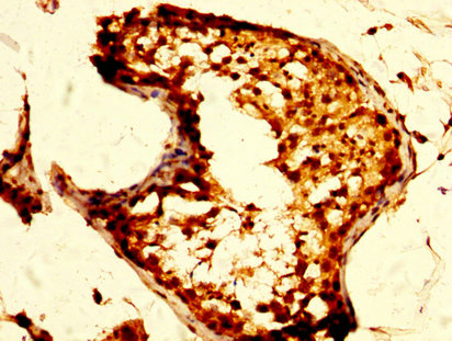 CSB-PA016361LA01HU
