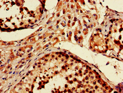 CSB-PA017451LA01HU