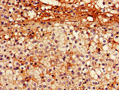 CSB-PA017451LA01HU