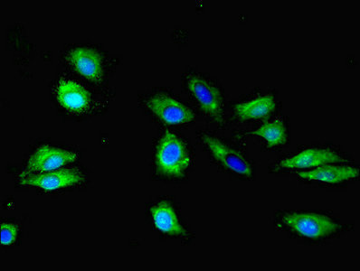 CSB-PA020650LA01HU
