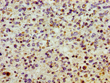 CSB-PA021844LA01HU