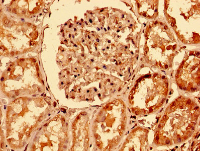 CSB-PA023964LA01HU