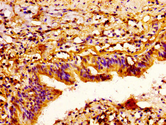 CSB-PA613506LA01HU