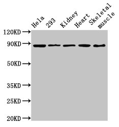 CSB-PA613506LA01HU