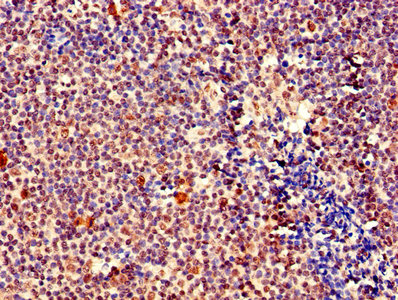 CSB-PA613522LA01HU