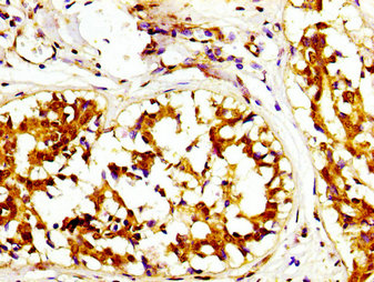 CSB-PA614529LA01HU