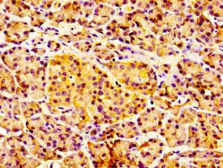 CSB-PA623807LA01HU