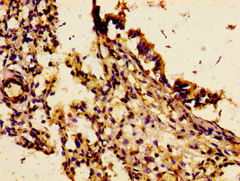 CSB-PA623807LA01HU
