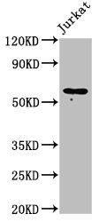 CSB-PA623807LA01HU