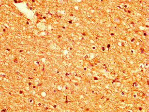 CSB-PA735975LA01HU