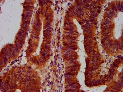 CSB-PA835713LA01HU