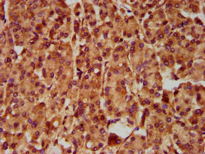 CSB-PA835713LA01HU