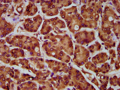 CSB-PA836275LA01HU