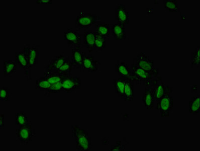 CSB-PA852915HA01HU
