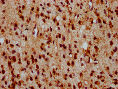 CSB-PA867138LA01HU