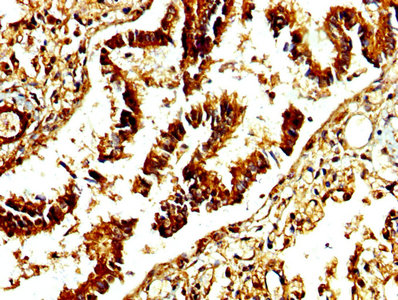 CSB-PA001311LA01HU