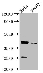 CSB-PA004955LA01HU