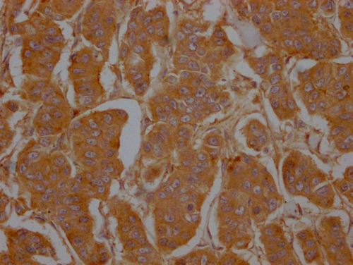 CSB-PA004969LA01HU