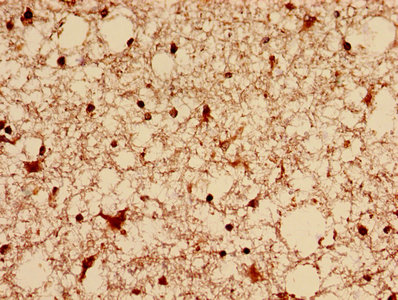 CSB-PA007078EA01HU