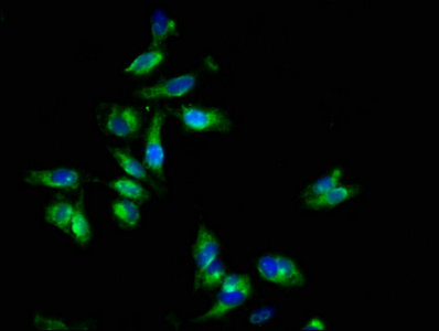 CSB-PA007744LA01HU