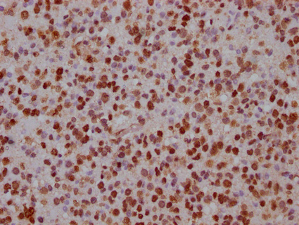 CSB-PA007945LA01HU