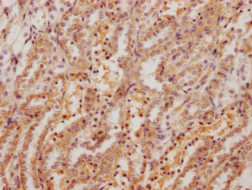 CSB-PA008759HA01RA IHC